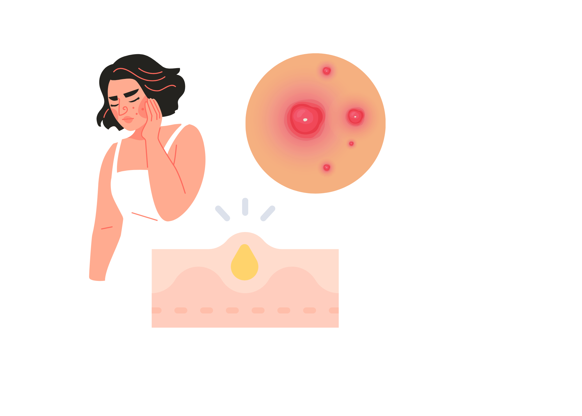 Skin Reset 2026: The Most Effective Acne-Fighting Skincare Right Now best acne products